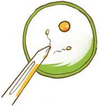 生殖補助医療のイラスト