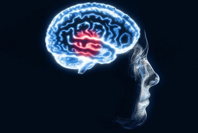 脳内に発生した問題を示すイメージ