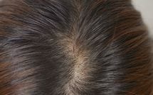 "抜毛症"に苦しむSAPIX女子に､家庭教師の罵声で薄毛になった子も…過酷な中学受験の世界で｢省エネ受験｣が流行る理由