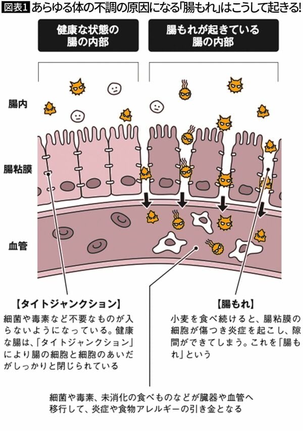 【図表1】あらゆる体の不調の原因になる｢腸もれ｣はこうして起きる! 