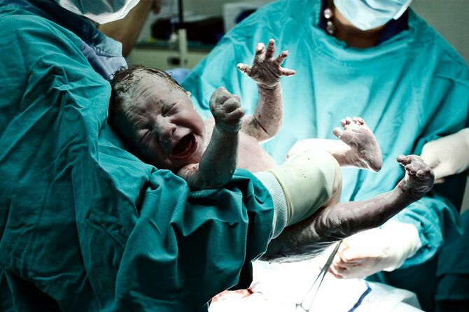 新生児の誕生