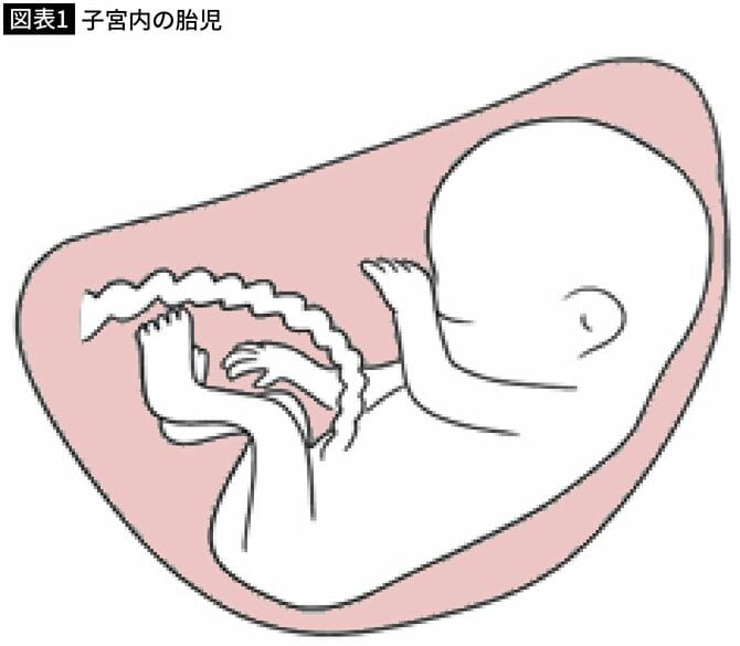 【図表1】子宮内の胎児