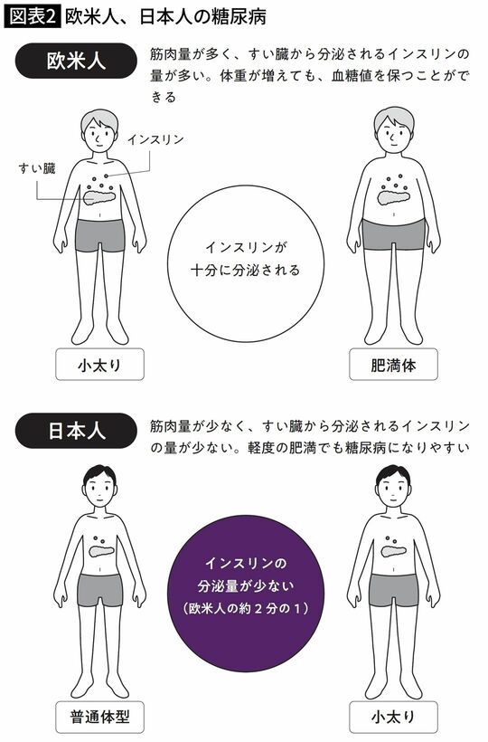 欧米人、日本人の糖尿病