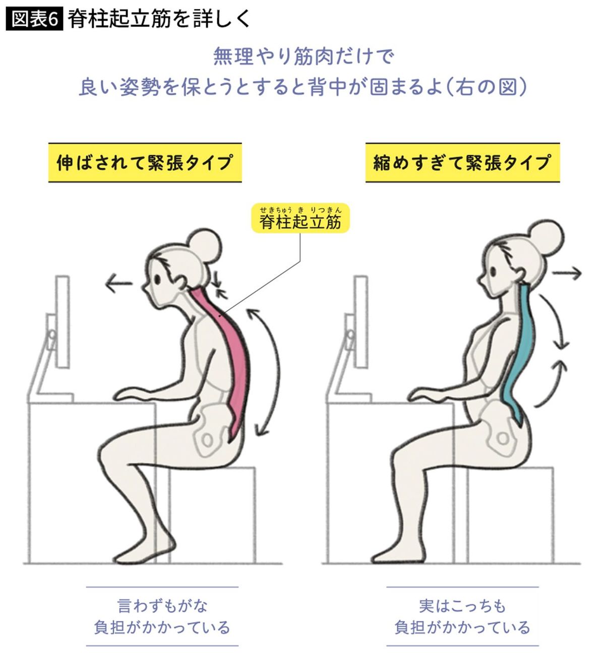 脊柱起立筋を詳しく