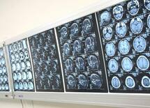 こんながん検診は受けてはいけない！