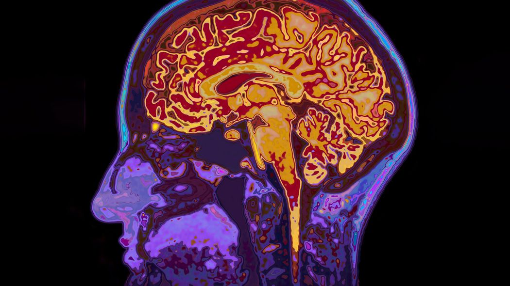 ｢認知症の約45%はこれで予防できる｣最新の大規模研究で判明した認知症予防に効く日常習慣と最強食材 60～79歳2000人以上を2年間にわたって追跡調査