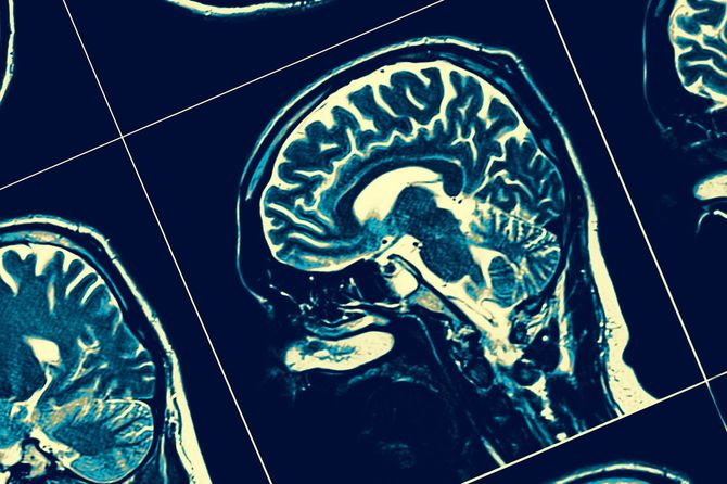 頭部のレントゲン写真