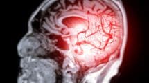 たった1時間の残業でも脳卒中リスクは確実に上がる…60万人調査で判明した｢働きすぎる人｣の不都合な真実