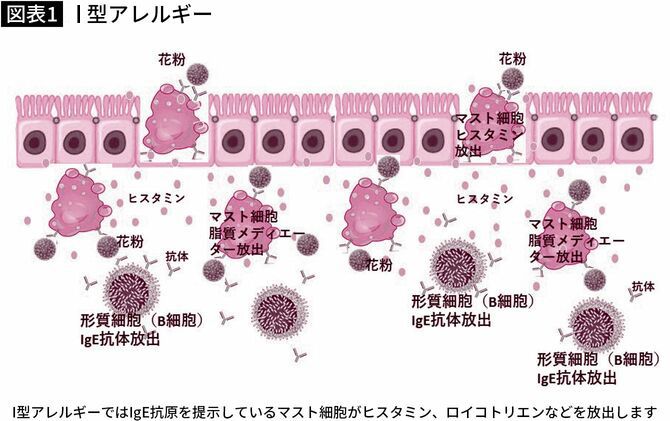 【図表】I型アレルギー