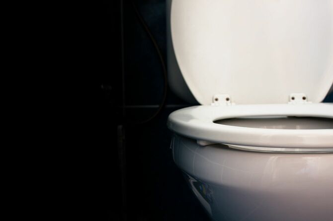 トイレは10年単位で汚れが蓄積し、便座も真っ黒