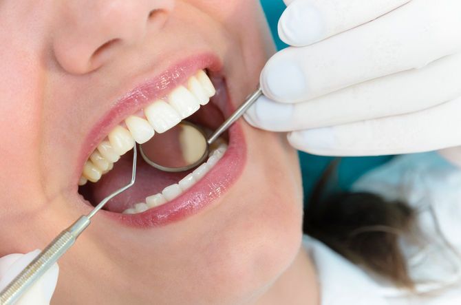 歯科検診を受ける若い女性