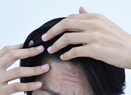 特定支出控除 カツラ代を確定申告で控除できるか President Online プレジデントオンライン