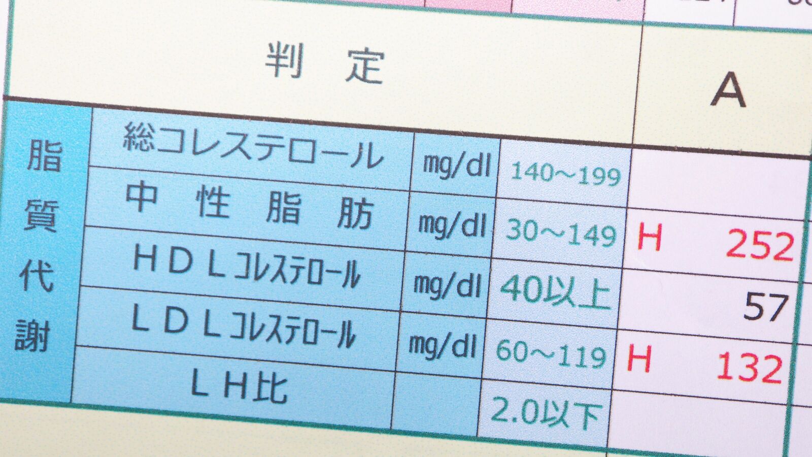 ｢塩分を控えれば健康｣は大ウソだった...儲け主義の｢デタラメ医師｣に殺される人が陥りがちなヤバい思考 医師の言うことを鵜呑みにすれば､あなたの健康寿命は削られる