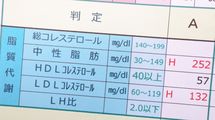 ｢塩分を控えれば健康｣は大ウソだった...儲け主義の｢デタラメ医師｣に殺される人が陥りがちなヤバい思考
