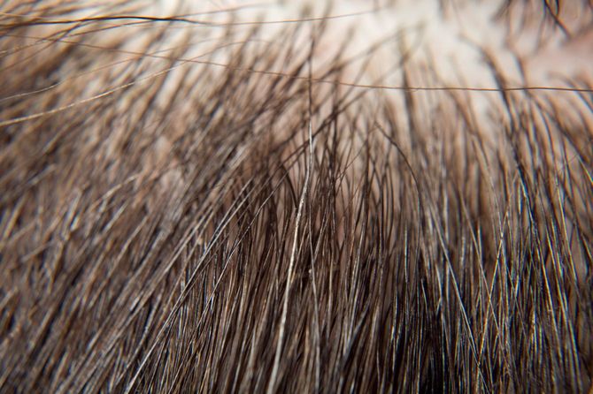 接写した女性の頭皮