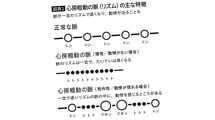 ｢トン-トン-トトトトトト｣と脈が速くなる…医師｢早く病院へ｣､最悪の場合は突然死に至る｢不整脈のリズム｣
