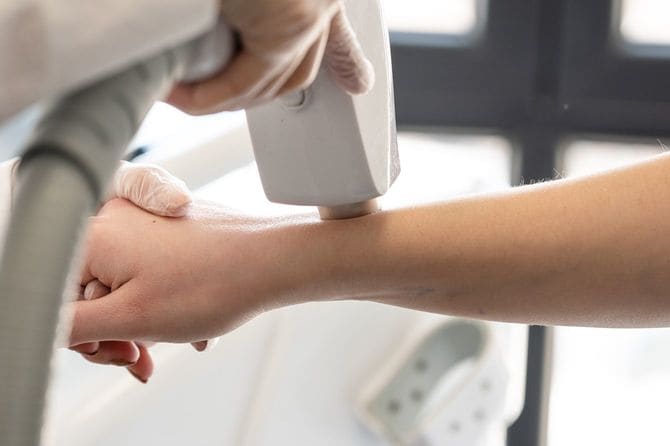 医療レーザー脱毛を受ける女性