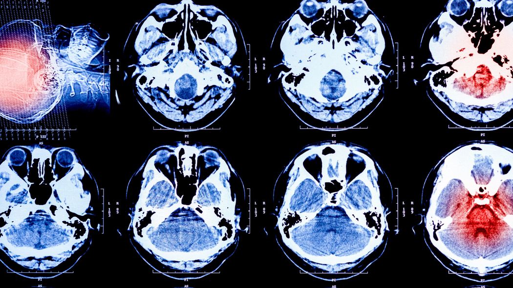 87歳義母が要介護5でも私は家で看る…10歳で実父に手を出された50代女性が再婚して出合った｢家族愛｣の壮絶 右半身麻痺､右半盲､右の聴覚もない…義母の介護を惜しまないワケ