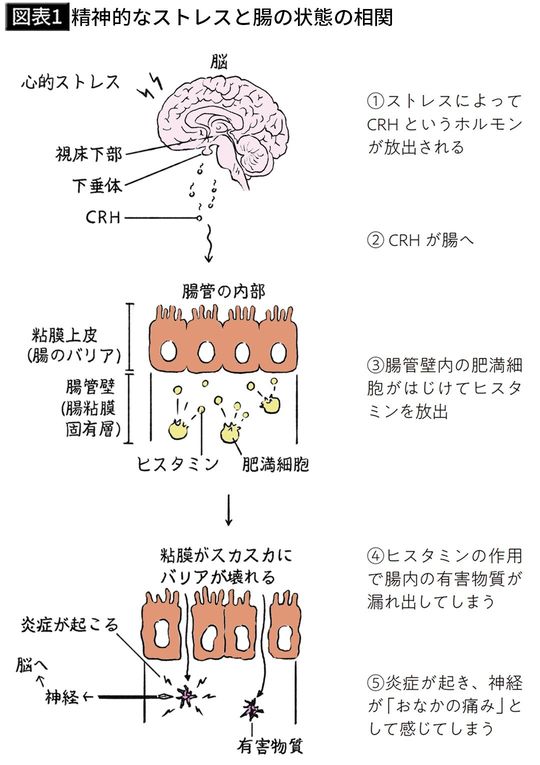 【図表1】精神的なストレスと腸の状態の相関