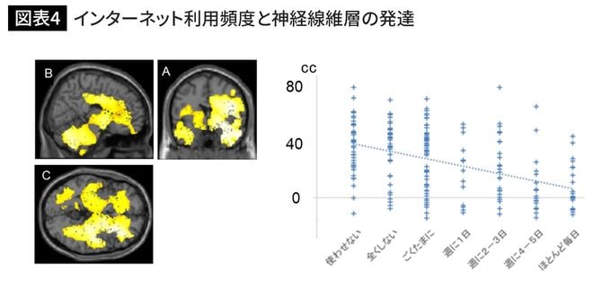 インターネット利用頻度と神経線維層の発達