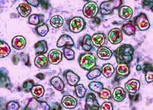 29歳以上がはしかワクチンを打つべき訳