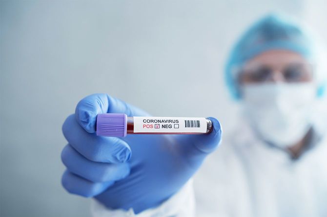 病院の実験室でのコロナウイルス血液検査