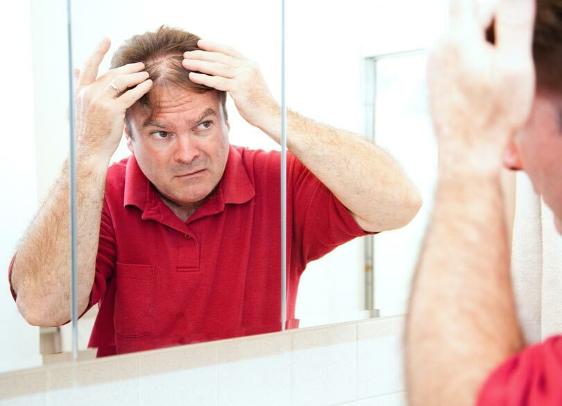 "昆布やワカメ"はハゲ防止の役に立つのか 「ヘアブラシで軽く叩く」は？