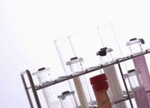 最高益続出！ 日本の総合化学企業の中で抜きんでるのは？