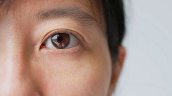 だから医師は必ず患者の下まぶたを下げて｢目｣を診る…白目やまぶたの裏に現れる｢重大な病気｣のサイン