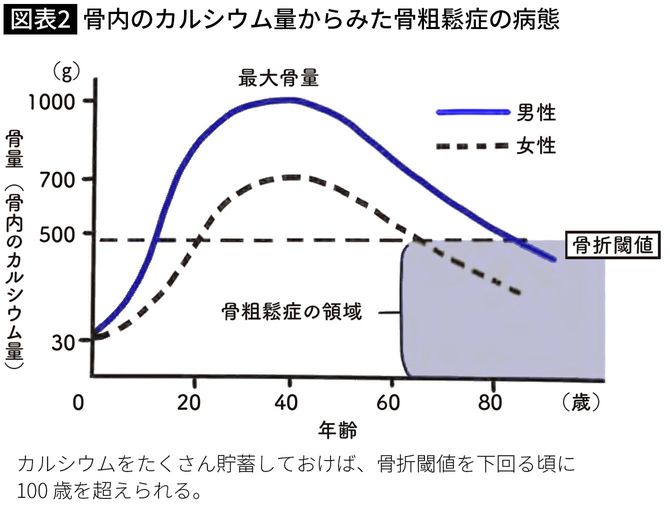 骨内のカルシウム量からみた骨粗鬆症の病態