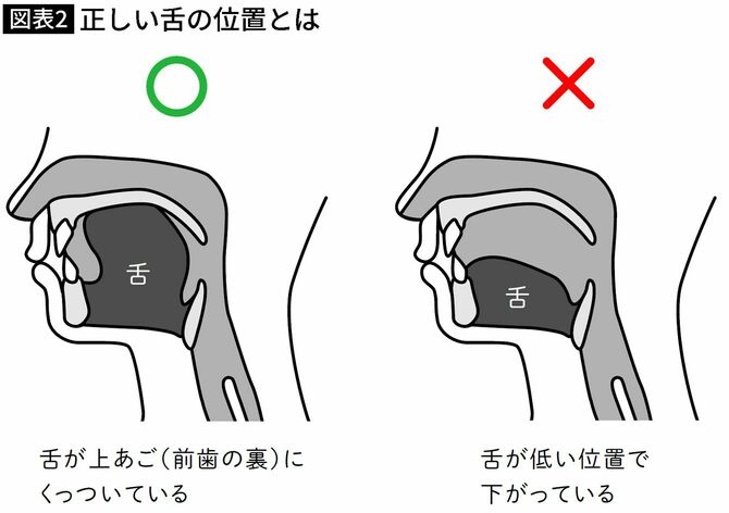【図表】正しい舌の位置とは