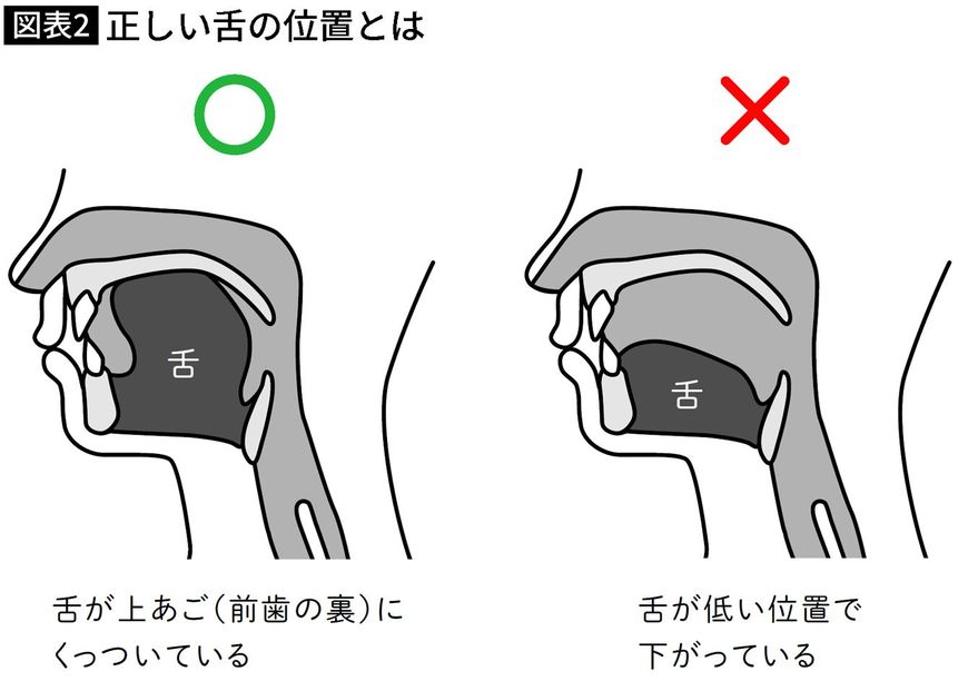 【図表】正しい舌の位置とは