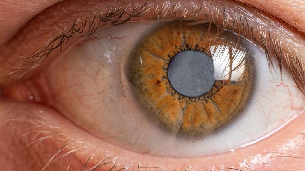 前夜は血圧180超…"決死"の白内障手術｢麻酔した目の中に見えたピンクと緑のオーロラ｣ 59歳女性作家の4泊5日の入院体験記