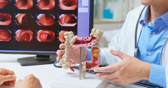 大腸内の検査について説明する医師