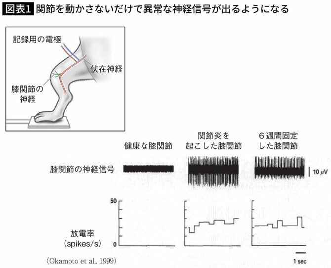 関節を動かさないだけで異常な神経信号がでるようになる