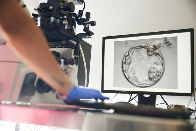 技術者が細心の注意を払って卵子の受精