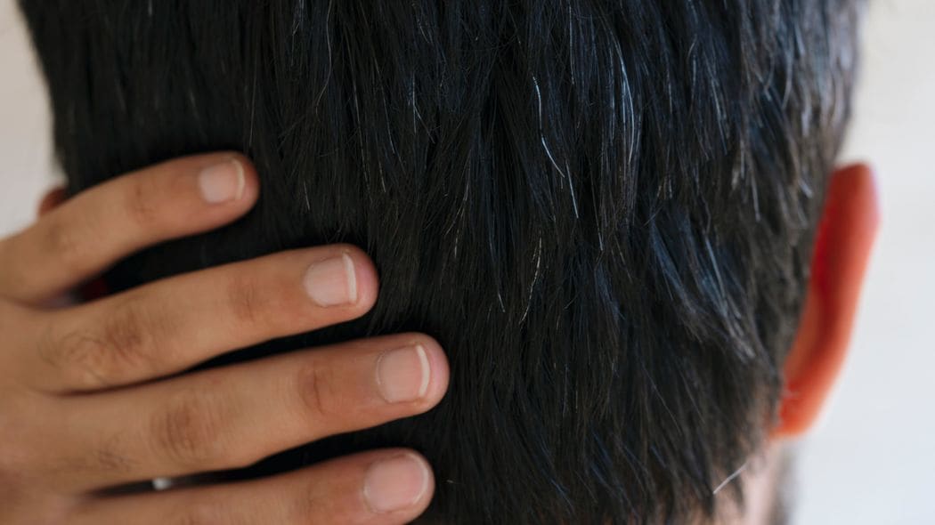 アラフォー独身の僕が｢憧れのロマンスグレー｣になるまでの老い方プラン 増え続ける白髪とどう付き合うか