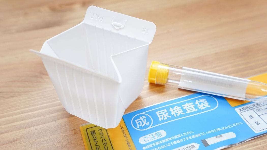 なぜ母ちゃんは俺に覚醒剤を打ったのか…｢小学校の尿検査が怖くて仕方なかった｣という非行少年の想い ｢兄ちゃんは祖父ちゃんに殴り殺された｣