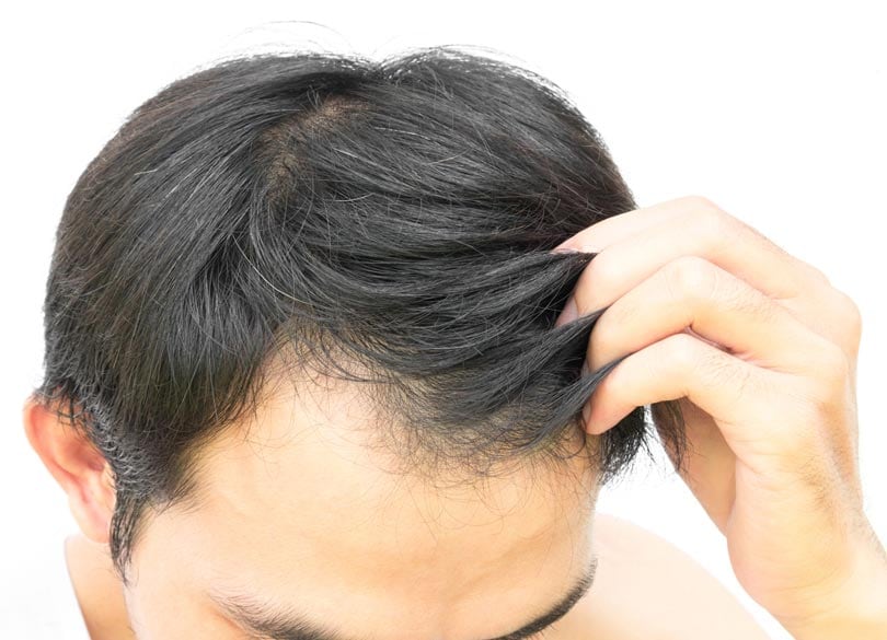 ヤフーが乗り出す毛髪診断ビジネスの中身 がんの予兆が5分で推測可能に？