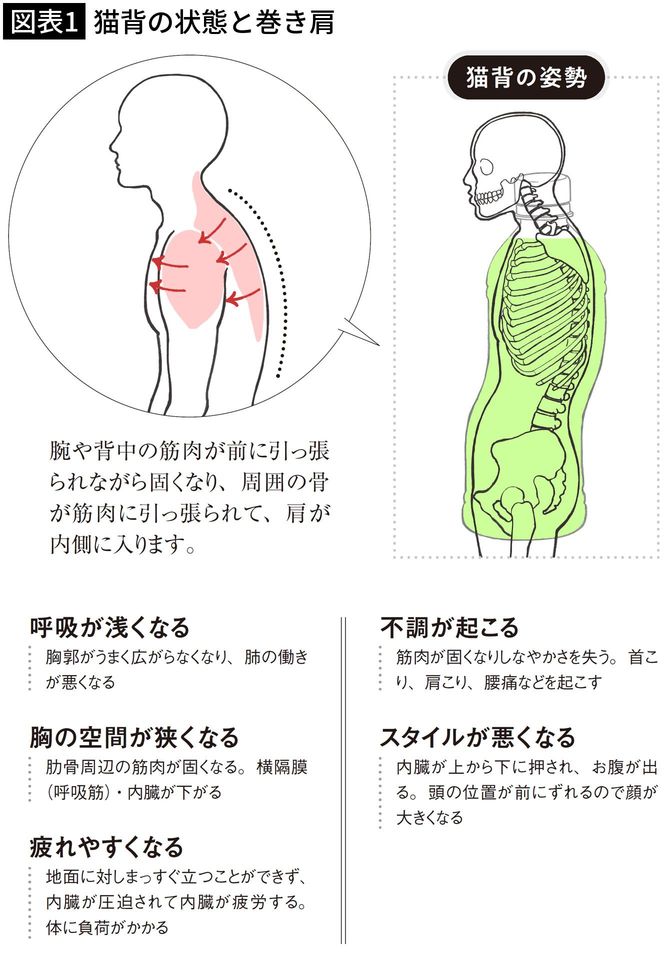 【図表1】猫背の状態と巻き肩