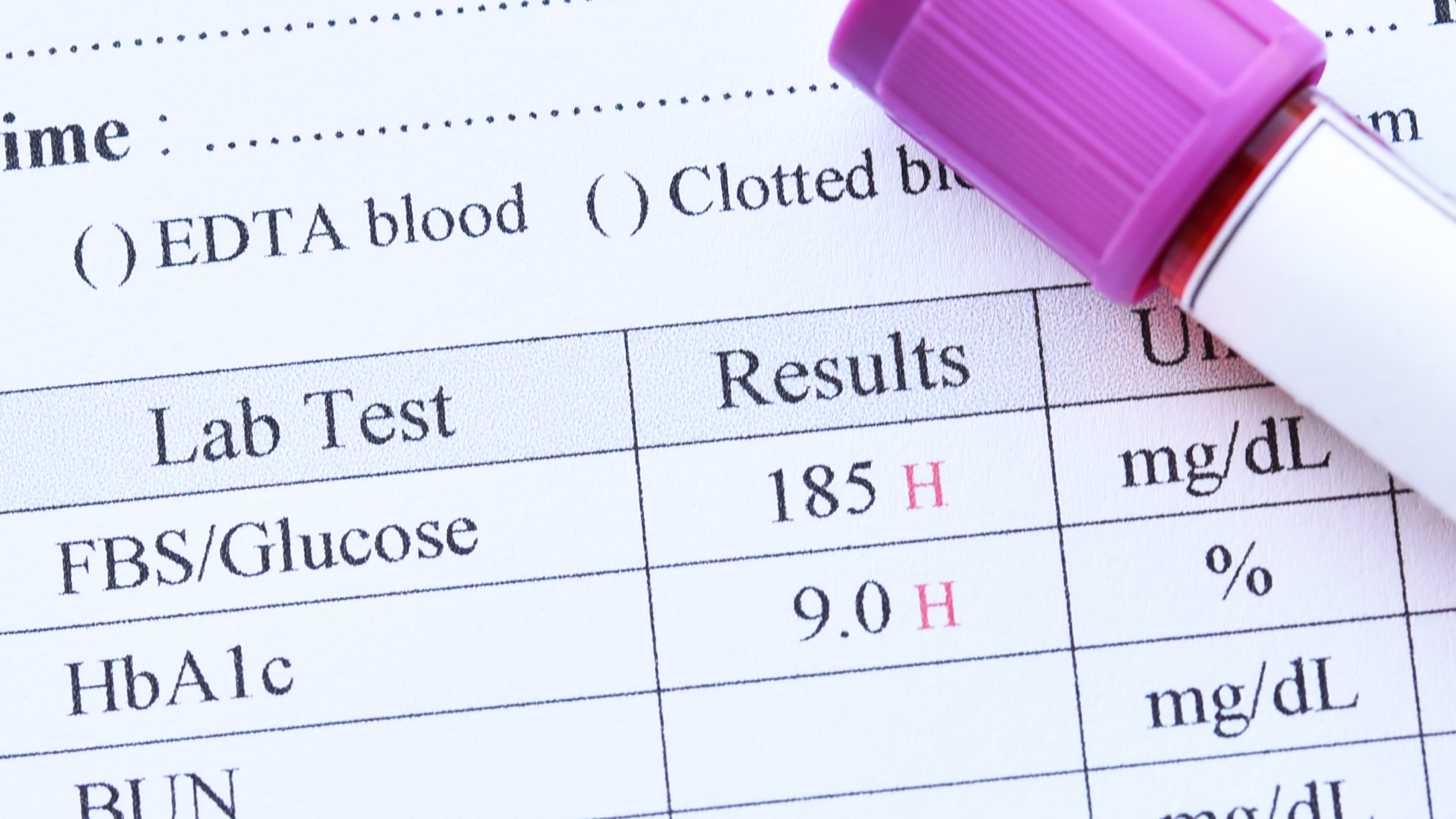 糖尿病の指標｢HbA1c 6%遵守｣は犠牲者を生むだけ…医師・和田秀樹が警鐘を鳴らす