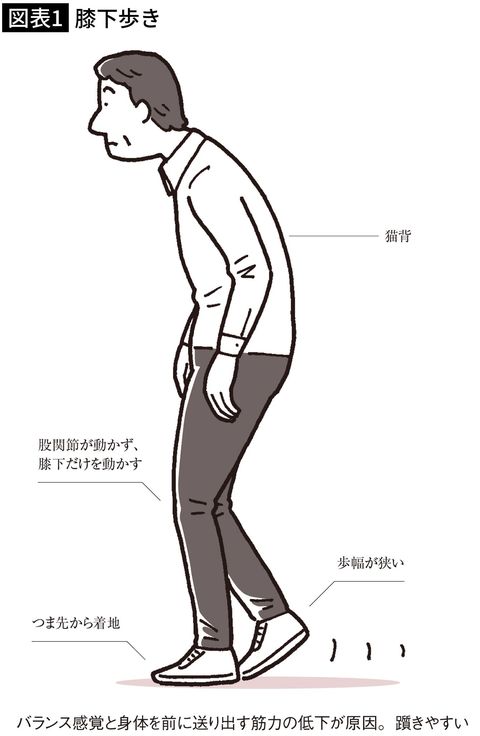 【図表1】膝下歩き