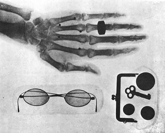 島津源蔵は日本で最初にレントゲン撮影を成功させた