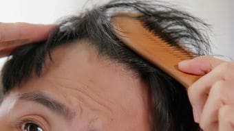 ヘルシーに見えて､｢薄毛｣リスクが上昇…専門医が｢血流の大敵｣と名指しする日本人が大好きな”白い食べ物”