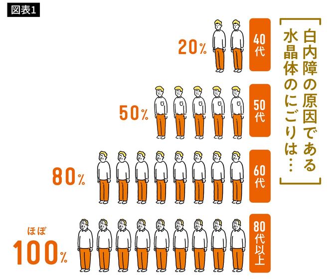 50代で半数の人の水晶体ににごりがあります