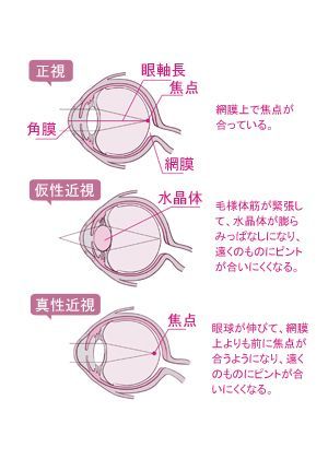 目の疲れに効く