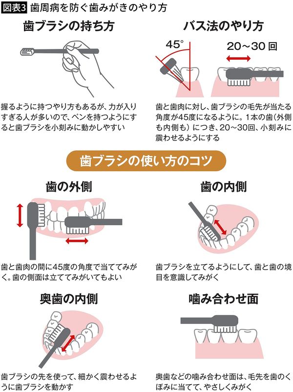 【図表3】歯周病を防ぐ歯みがきのやり方
