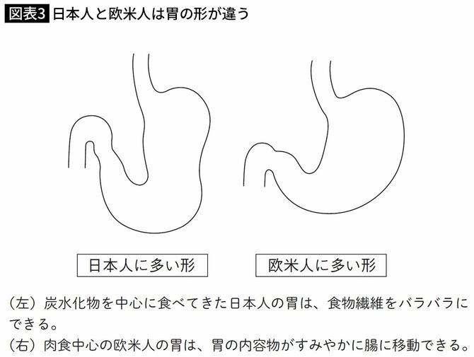 日本人と欧米人の胃の形の違い
