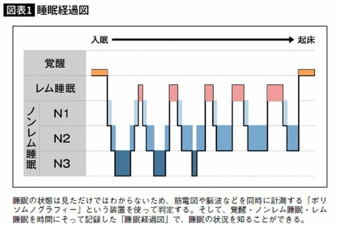 睡眠経過図