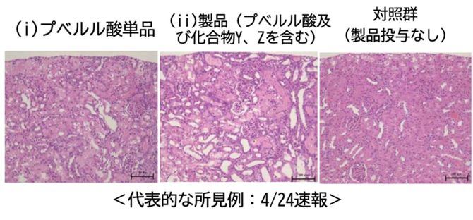 厚生労働省資料に掲載されたラットに投与した試験における近位尿細管の変性・壊死の所見例